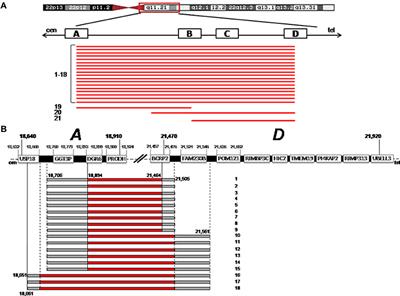 Deletion Extents Are Not the Cause of Clinical Variability in 22q11.2 Deletion Syndrome: Does the Interaction between DGCR8 and miRNA-CNVs Play a Major Role?